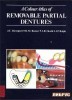 A Colour Atlas of Removable Partial Dentures